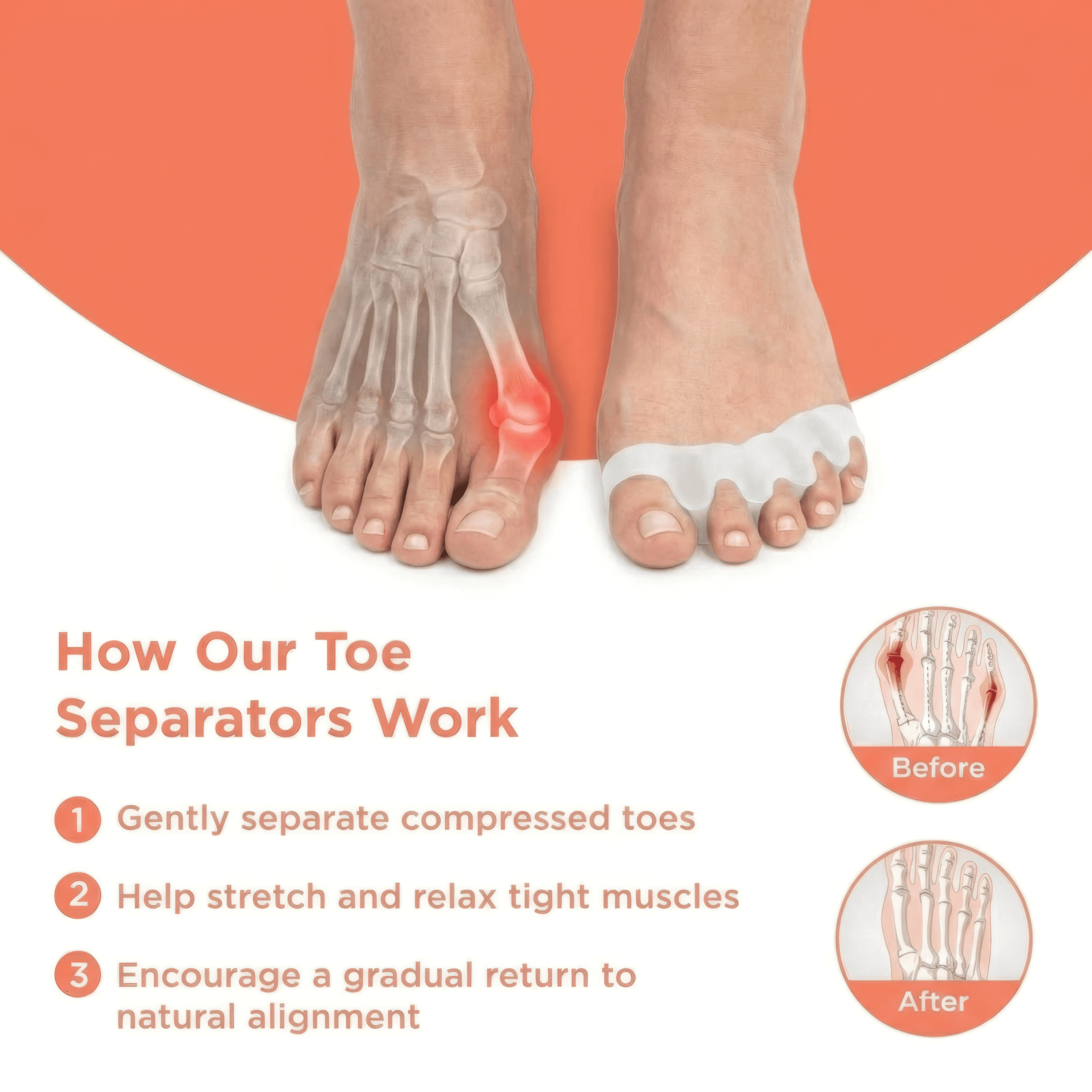 Toe Relief Spacer 2